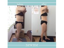 ニュウミー 諏訪本店(newme)/お客様ビフォーアフター