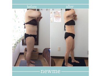 ニュウミー 諏訪本店(newme)/お客様ビフォーアフター