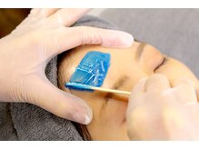 アメリ(Ameri)/おでこのWAX脱毛