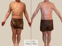 アージェム(AGEM)/【インディバ痩身】2ヶ月-4kg減