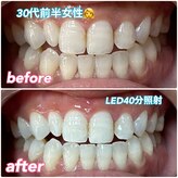 ホワイトニングビューティー 西宮店