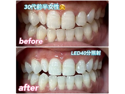 ホワイトニングビューティー 西宮店の写真