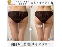 ビナル(BeNAL)/痩身☆ハイパーナイフB/A