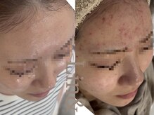 リノアンド(Lino&)の雰囲気（オーダメイド式の施術メニューで肌育成。元看護師による施術。）