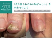 地爪ケアクリニックサロン 代々木店の雰囲気（長年にわたる爪のお悩みも一度ご相談ください！）