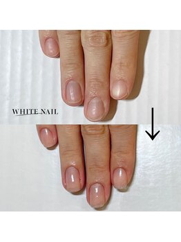 ホワイトネイル 武蔵小杉店(WHITE NAIL)/ネイルケア・自爪育成・爪育