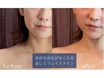 シンシア(sincere)/たった1回でこれだけ変わる