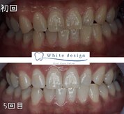 ホワイトデザイン 岐阜店(White design)