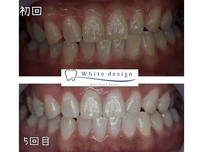 ホワイトデザイン 岐阜店(White design)の写真