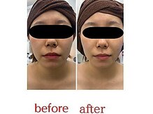 ステラ(Stella)の雰囲気（最強小顔1回目）