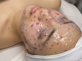 アイコトバ バイ ジュモク(アイコトバ by Jumoku)の写真/【フェイスWaxでスキンケアの底上げ!】お顔の産毛、ムダ毛、毛穴詰まりをWaxでお取りします♪