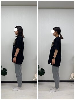 ラフテル鍼灸整骨院/整体×ピラティスで肩こり改善！