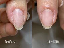 ニーヨンゼロ(240)/変形爪