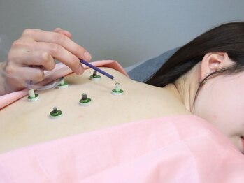 鍼灸院Amu-アム-【2/5 NEW OPEN(予定)】 の写真/【オーダーメイド施術】一人ひとりの不調に寄り添います◎肩こり・腰痛、冷え、自律神経の乱れ等もお任せ!