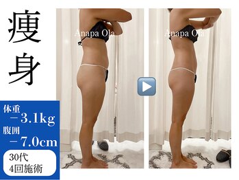 アナパ・オラ/オトナ女子の華奢見え痩身