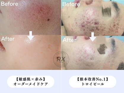 オン(on.)の写真