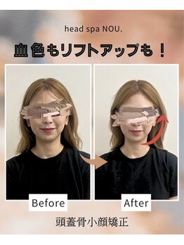 ノウ(NOU.)/沖縄ヘッドスパ／沖縄小顔矯正