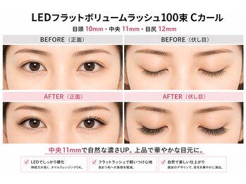 チック(chick)/迷ったらこれ◇LED100束