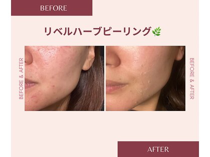 ワイズビューティ(Y’s Beauty)の写真