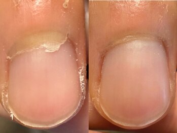 メンズ ネイル トノ(Men's Nail TONO)/Step8