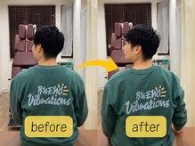 可児ボディーメイク接骨院/寝違い（男性）