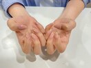 ハンドnail