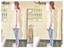 名古屋栄 肩こり腰痛専門整体 らーく/お客様のbefore、after