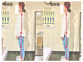 名古屋栄 肩こり腰痛専門整体 らーく/お客様のbefore、after