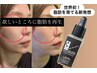 世界初！【コケ頬/たるみ毛穴】脂肪再生！ふっくらハリ肌フェイシャル