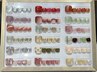 【FOOT】【夏デザイン】◇初回オフ無料◇パラジェル◇ 店頭デザインコース