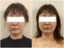 ウェリナ平和堂長久手院/小顔矯正/骨盤矯正/美脚サロン