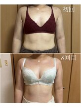 エース(A)/BカップからDカップへ