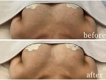 ルナリア ルクス 志木南口駅前店/デコルテ下からふっくらバスト