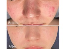 アンドミルル(and Milulu)の雰囲気（豊田市で肌質改善！ニキビ・毛穴を根本ケアし″すっぴん″に自信）