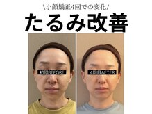 キュープ 鹿児島伊集院店(Qpu)/