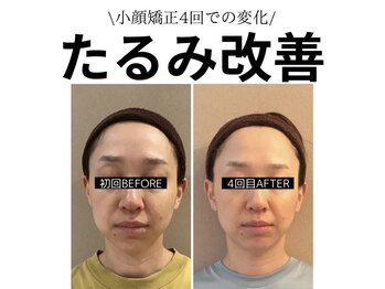 キュープ 鹿児島伊集院店(Qpu)/