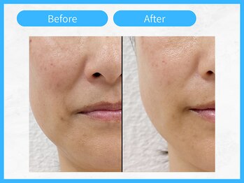 トウメイコガオ 横浜店/トウメイコガオでハーブ