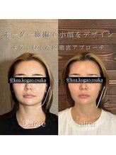 コア 中目黒店(Koa)/お客様ビフォーアフター！！