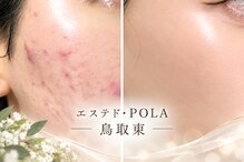 ポーラ エステ ド 鳥取東店(POLA)