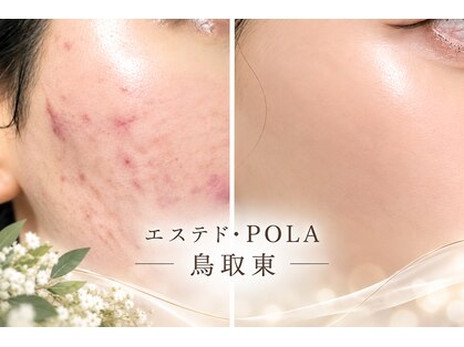 ポーラ エステ ド 鳥取東店(POLA)の写真