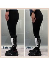 セア(SeA)/☆ヒップアップ2ヶ月変化☆