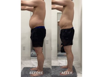 ナルシス/【痩身】1回の変化★全身ケア