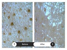 リジュ(Reje)/毛穴ケア