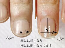 トゥインクリーネイルサロン(Twinkly Nail Salon)/【最強のネイルケア】1回お試し