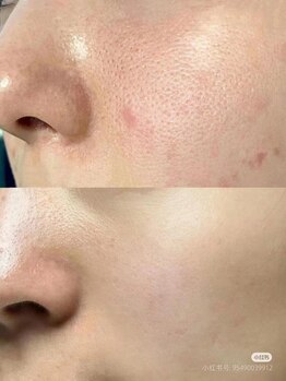 イーズン(Easen)/