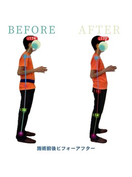 アティチュード 高崎(ATTITUDE)/小さいころから姿勢が悪い悩み