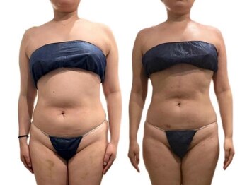 痩身革命 大宮店/リンパマッサージで結果をだす