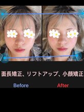 美容矯正サロン レレポノ(LELEPONO)/