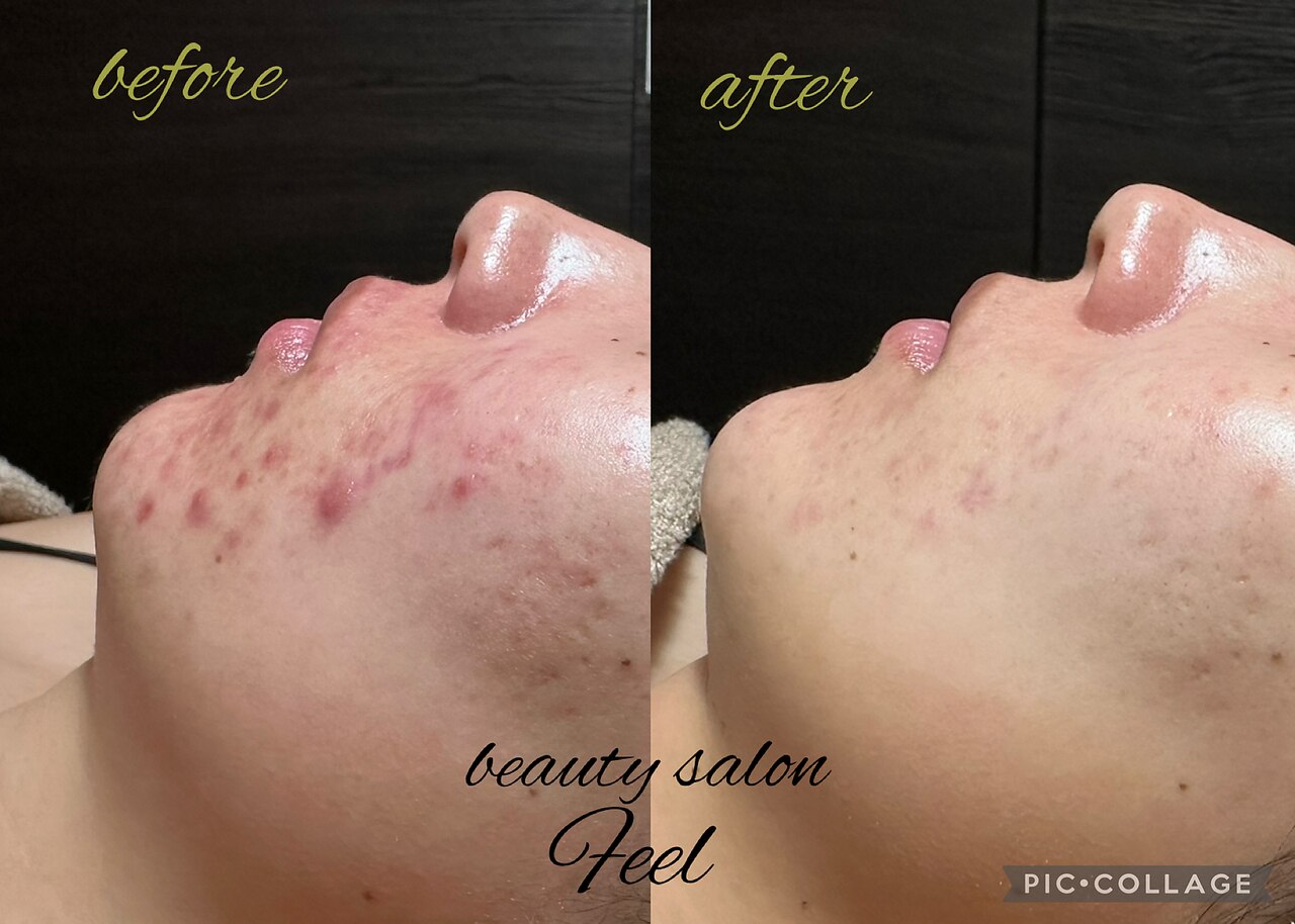 フィール(feel)｜ホットペッパービューティー