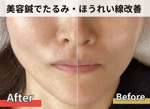 ナチュラルエイジングプラス(naturalaging+)